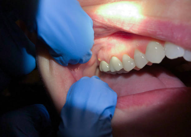 Best Weekend Emergency Dentist in Meiners Oaks, CA